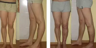 How to recognize the shape of the legs?